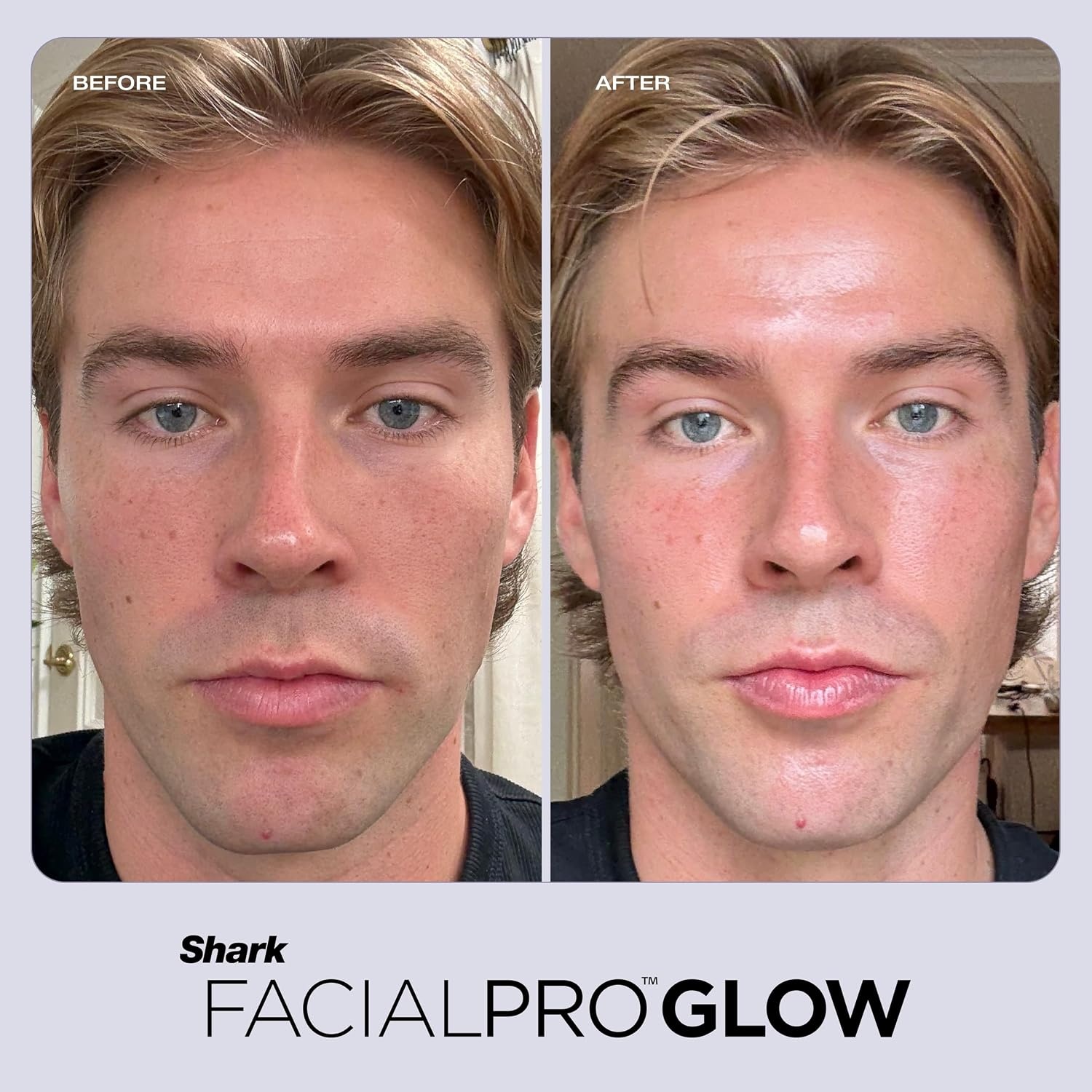 image:imageShark FacialPro Glow DePuffi 2in1 Facial amp Contrast Therapy FH320PLFacialpro Glow Depuffi Lilac
