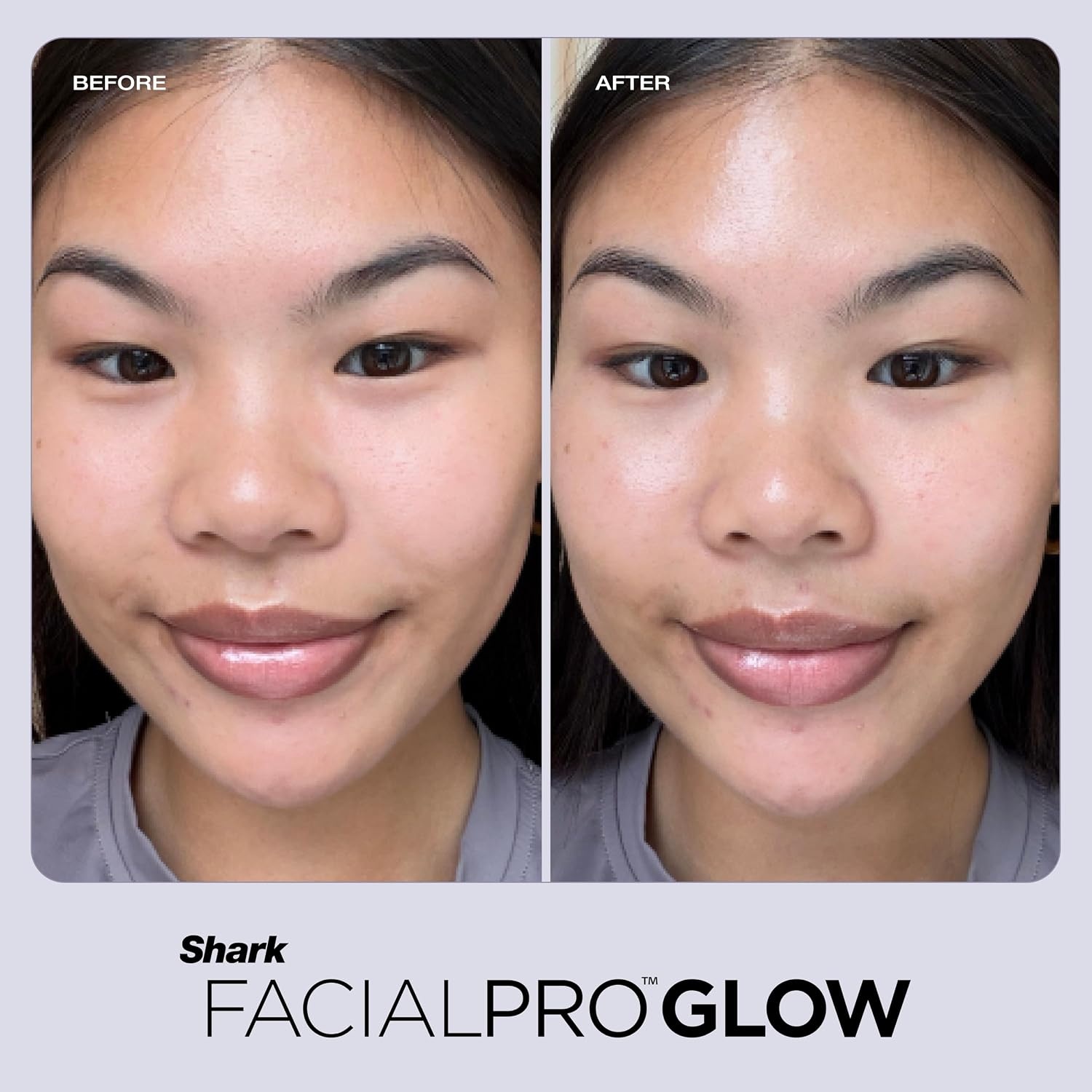image:imageShark FacialPro Glow DePuffi 2in1 Facial amp Contrast Therapy FH320PLFacialpro Glow Depuffi Pink